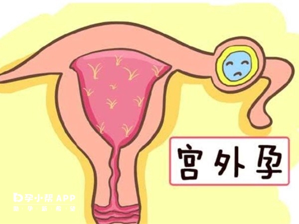 宮外孕hcg峰值有可能會上2000