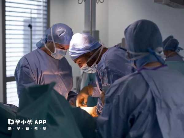 睪丸穿刺取精手術不需要住院