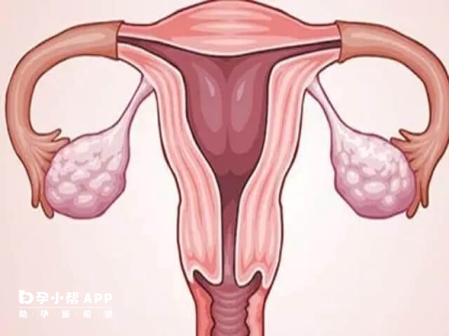 內分泌失調會導致內膜變薄