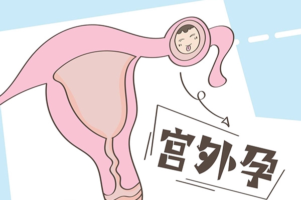 試管移植鮮胚宮外孕機率不大