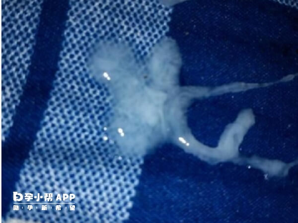 死精率高做一代試管成功率