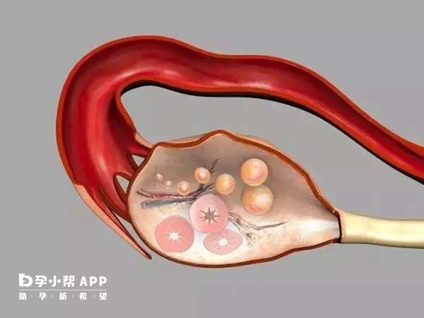 自然週期卵泡大於18mm可取卵