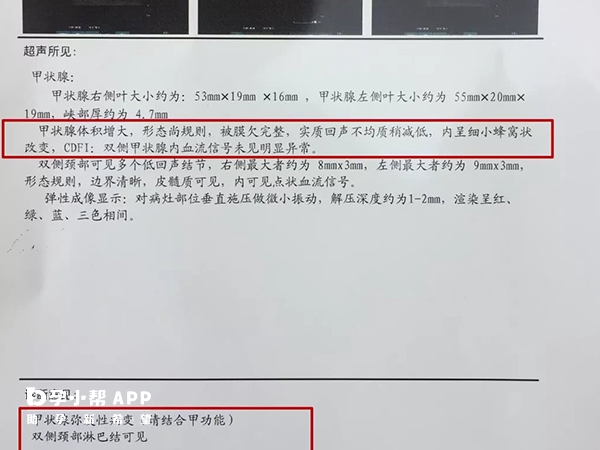 甲狀腺功能異常不能做試管