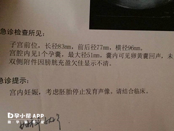胎停2次或與免疫疾病有關