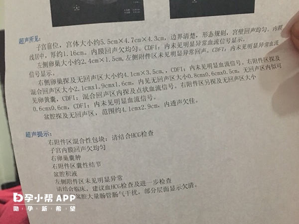 凍胚移植後hcg20或是宮外孕