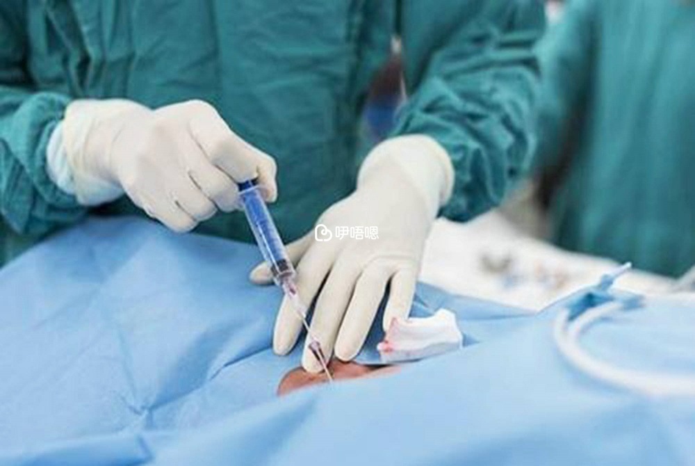 剖腹產是生產方式之一