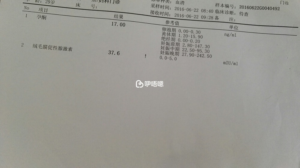 孕期hcg檢查報告單