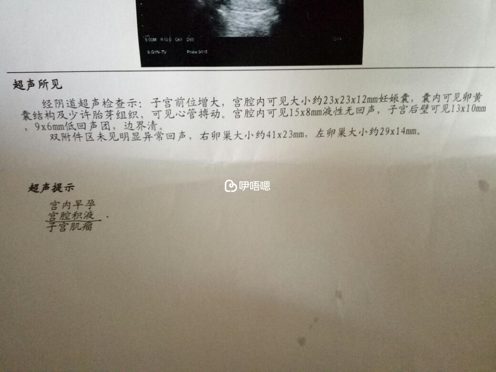 孕期宮腔積液報告單