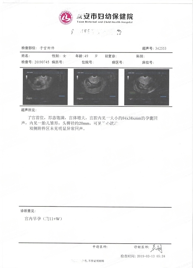 49歲H姐的孕期檢查報告