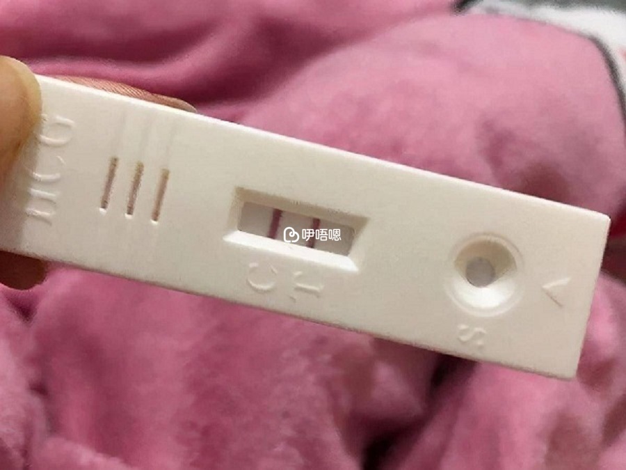 無精症試管成功懷孕