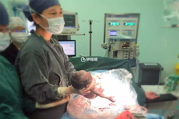 培養皿中精子與卵子自由結合