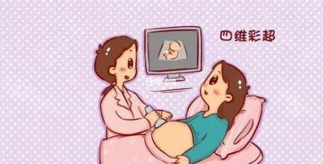 四維彩超檢查