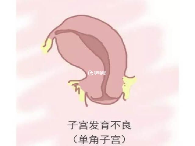 單角子宮試管成功率高嗎