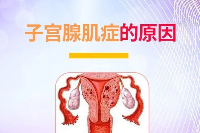 引起子宮腺肌症的原因