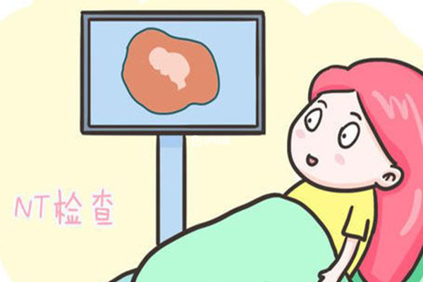 nt檢查是孕期必做的專案之一