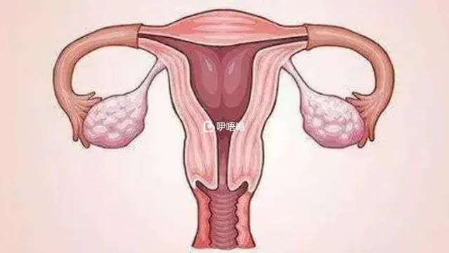 雙角子宮是什麼