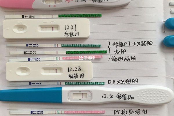 第二代試管嬰兒
