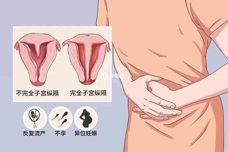 縱隔子宮危害嚴重嗎