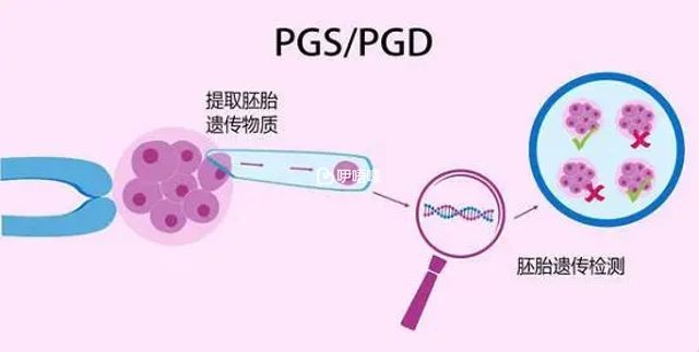 PGD和PGS技術