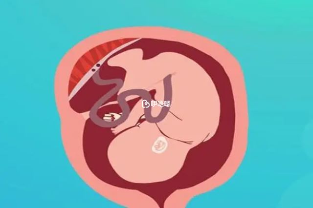 單角子宮生孩子有危險嗎