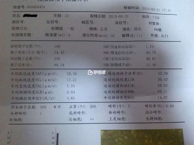 精液常規檢查專案報告