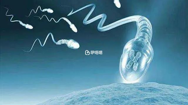 Y精子分離術