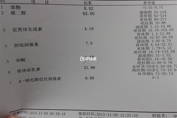 睪酮正常值在014-0.76ng/ml