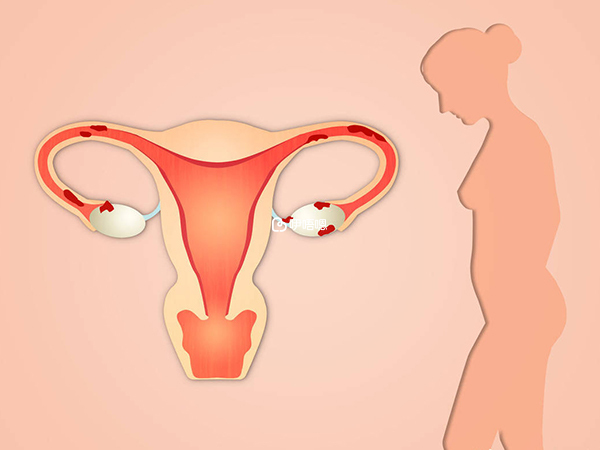 35歲之後的女性,生育力逐年下降