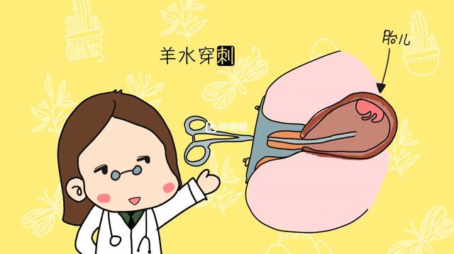 什麼是羊水穿刺檢查