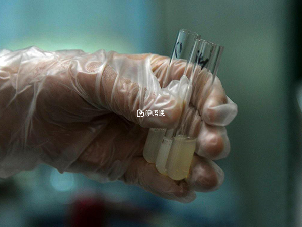 男性的精液檢查簡單方便