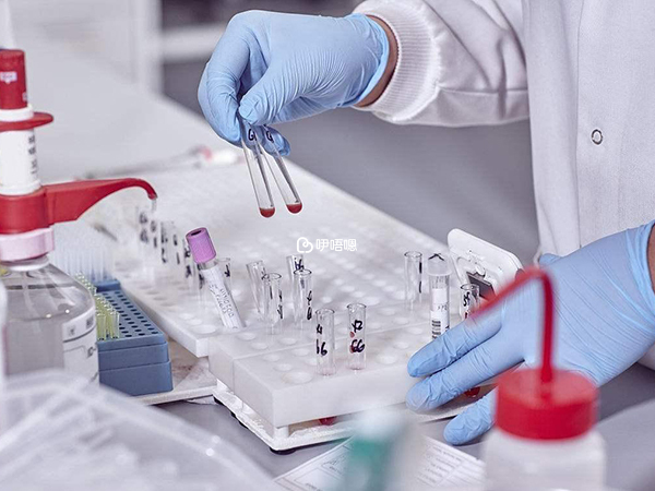 可以通過血液檢查是否有腎炎