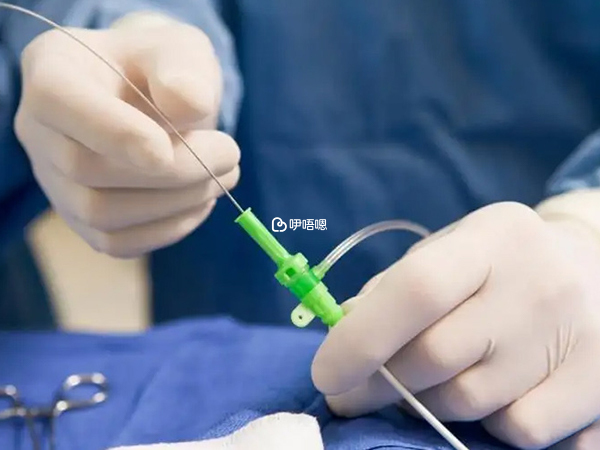 宮腹腔鏡手術後三個月儘量懷孕