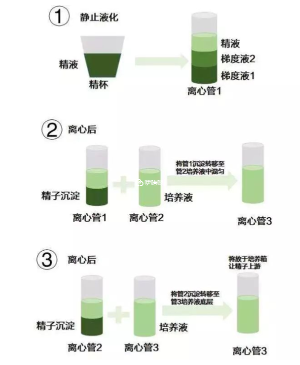 HIV洗精術的方法