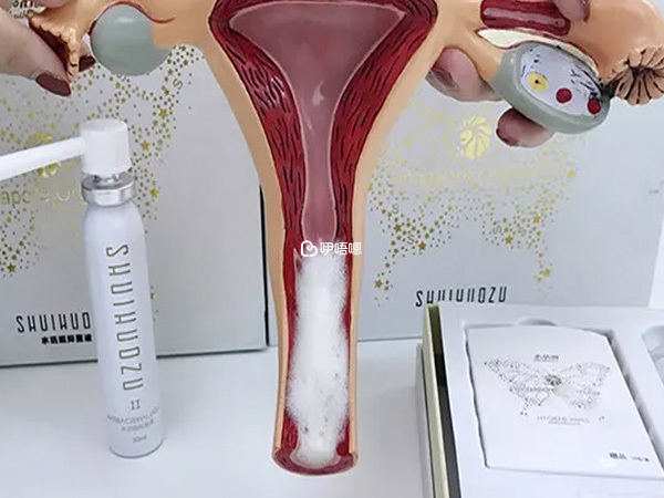 巧囊患者就診時可以考慮區婦幼的張醫生