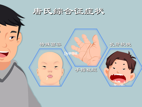 唐篩檢查可篩檢出60-70%的唐氏症患兒