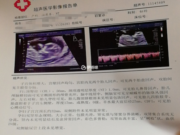 成功懷孕的B超單