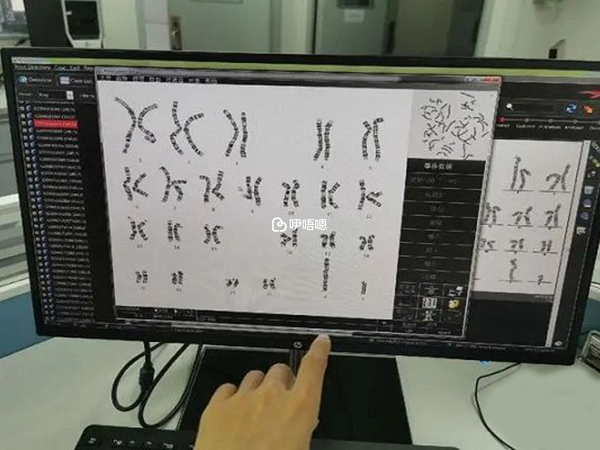 唐篩不建議做兩次