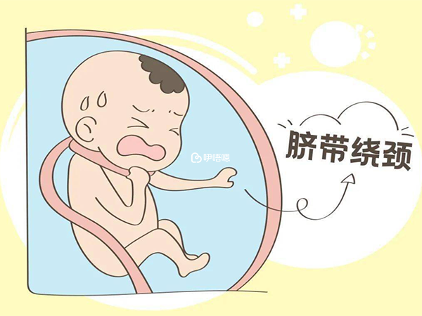 羊水臨界臍繞頸兩週不建議做操糾正胎位