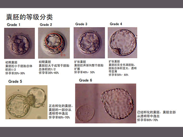 囊胚等級與妊娠率、妊娠繼續率、流產率有關