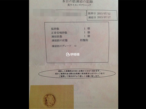 樂觀的心態對卵子很有好處