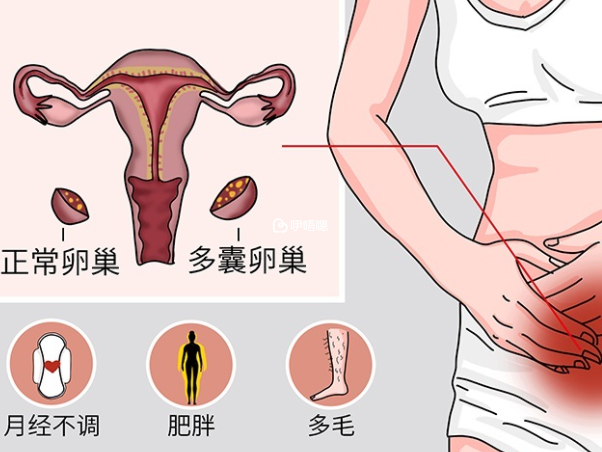 多囊吃達英可以把激素調理正常