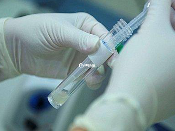 HIV洗精技術已經逐漸成熟