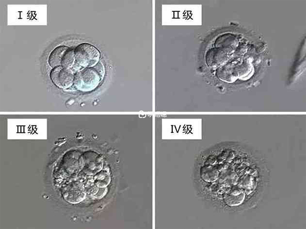 胚胎等級