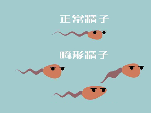 滋腎育胎丸有一定改善精子畸形的作用