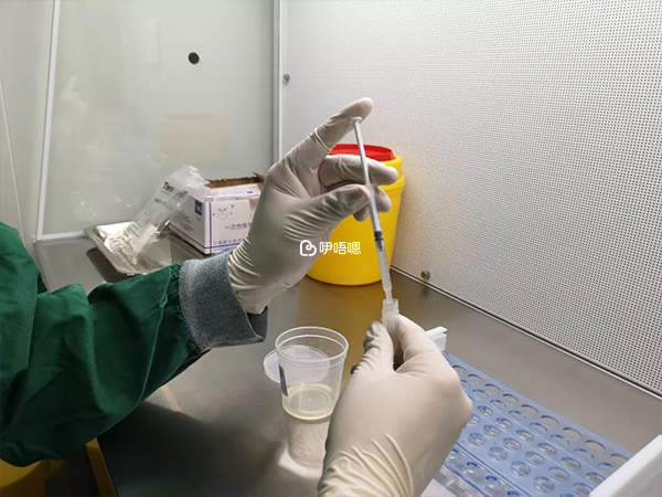 男方做精子檢查