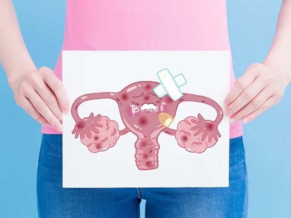 雙側巧囊及子宮腺肌症