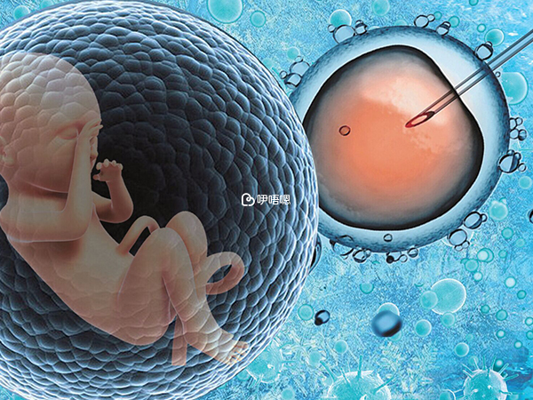 巧克力囊腫做試管嬰兒