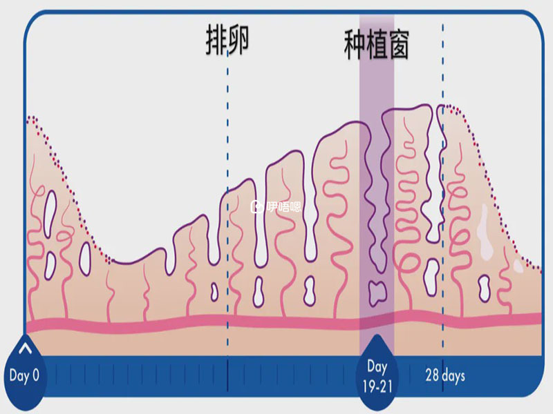 種植窗有沒有必要做的情況