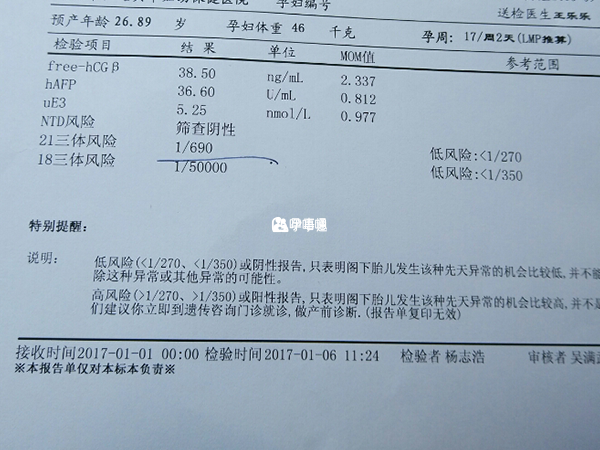 18三體可篩查染色體異常疾病