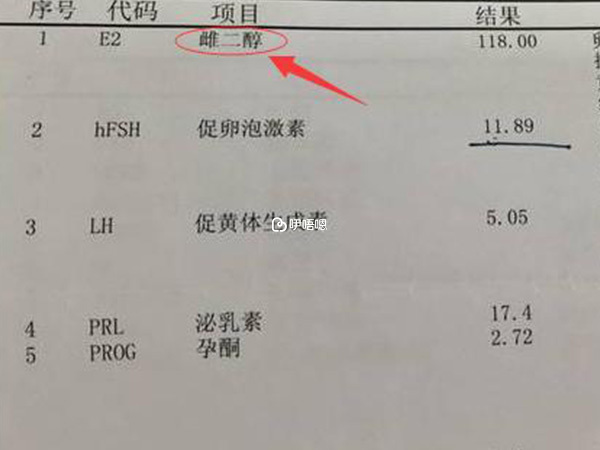 fsh檢查結果報告單